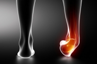 What Are the Symptoms of an Ankle Sprain?
