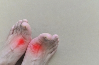 Gout Is a Painful Form of Inflammatory Arthritis