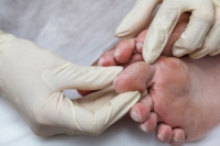 Managing Diabetic Foot Infections
