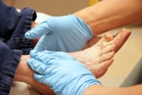 Diabetes and Podiatry